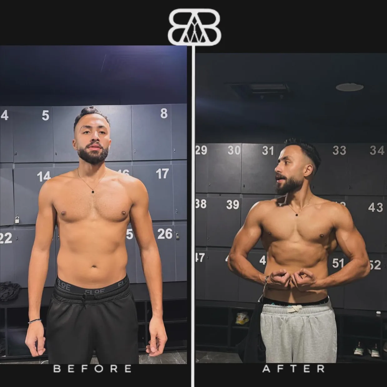 Omar — before and after, front view.
